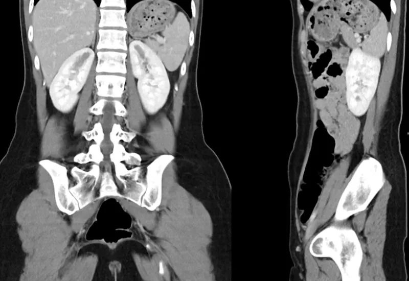 Nuclear Medicine