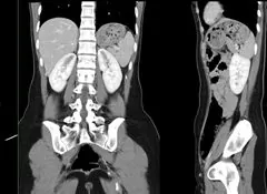 Nuclear Medicine